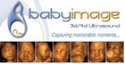 Ultrasound - Baby Image 3D-4D Ultrasound - Sugar Land, TX
